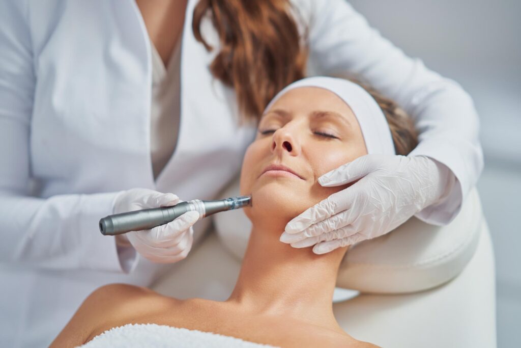 Microneedling with Hyaluronic Acid Gentle Touch Lasers