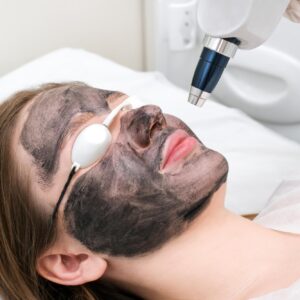 Carbon Peel Laser