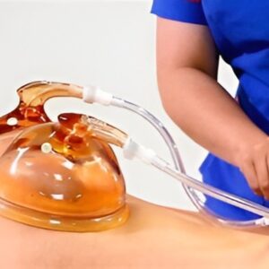 Vacuum Butt Lift & Cupping Treatment